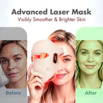 JOVS LED Photon Rejuvenation Face Mask