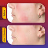 LumaSkin Pro 2.0 | LED Facial Mask