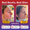 LumaSkin Pro 2.0 | LED Facial Mask