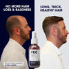 FEGPlus Minoxidil Beard & Hair Growth Serum