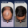 FEGPlus Minoxidil Beard & Hair Growth Serum